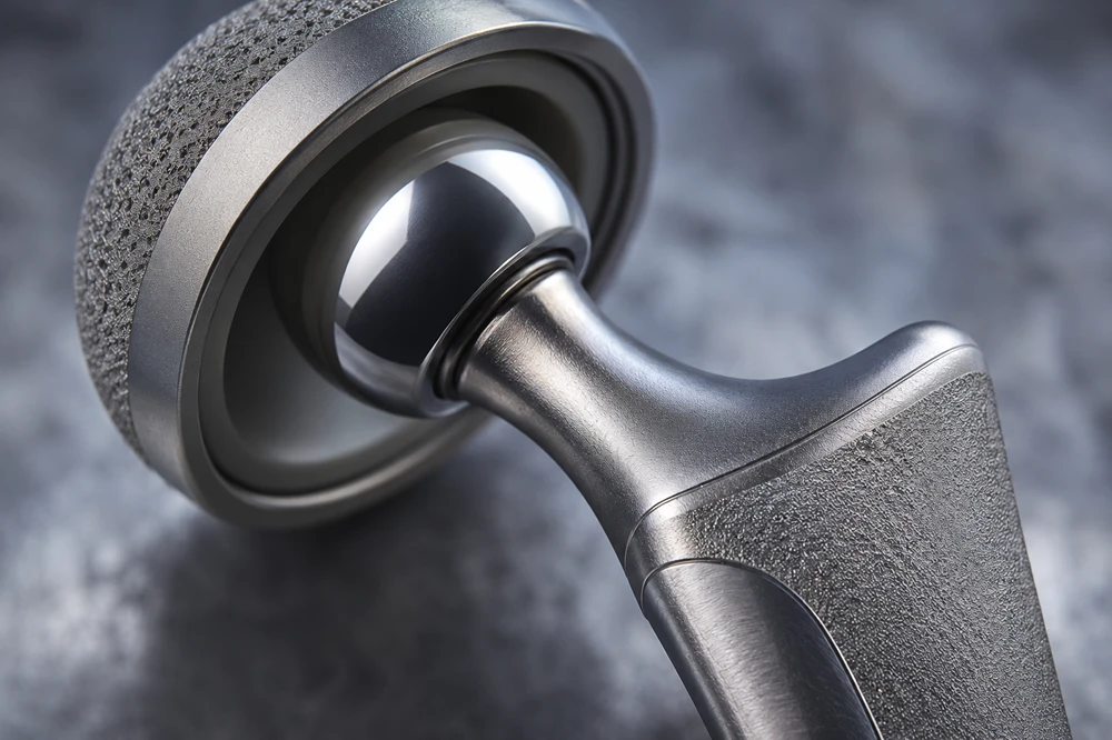 Precision-machined titanium medical implant showcasing organic geometries made possible by 5-axis CNC milling